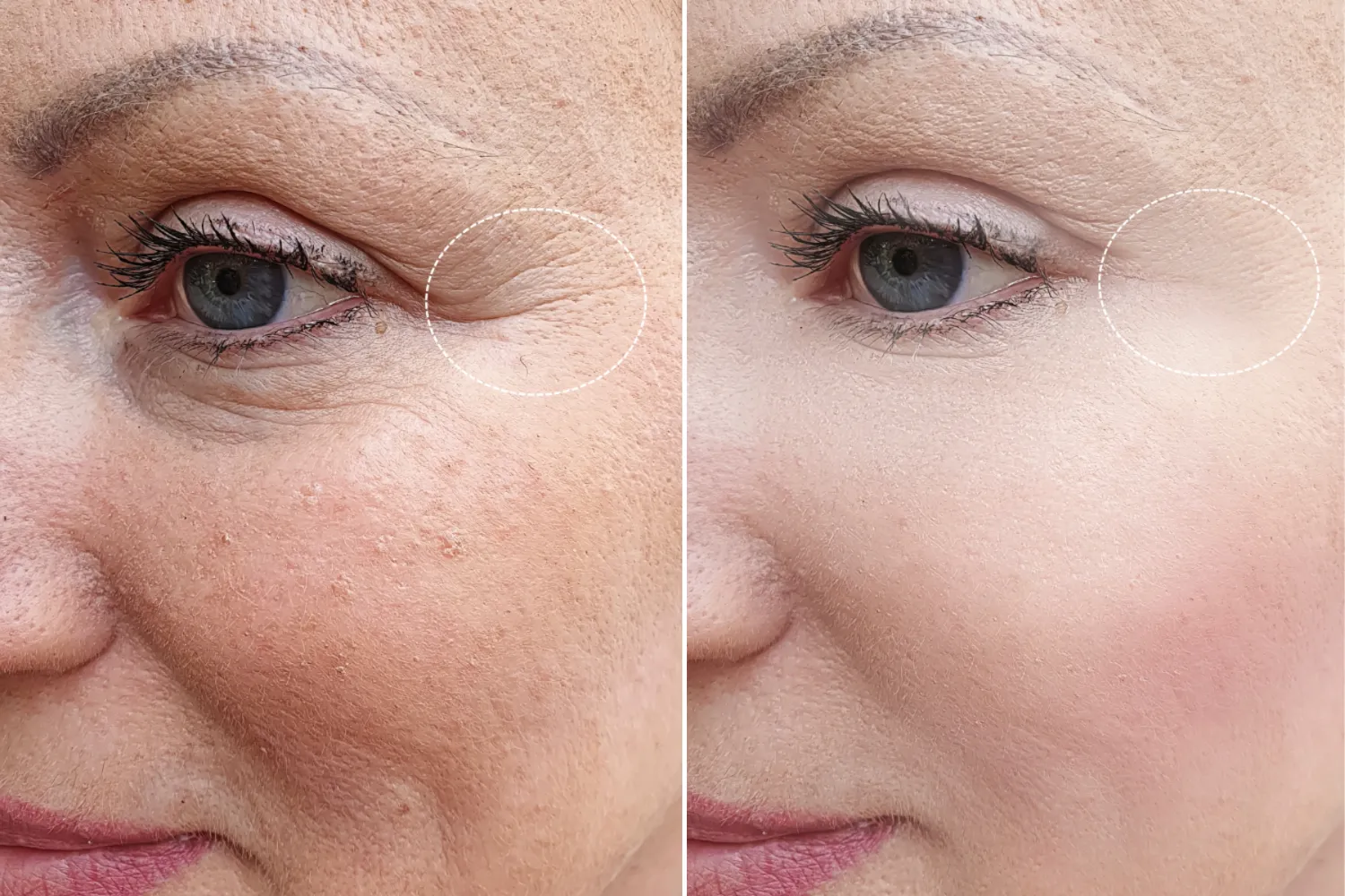 Visible Healthier Skin
